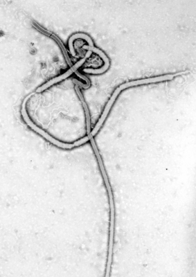 Angst vor Ebola in Westafrika